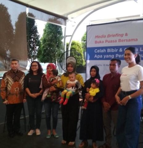 Perawatan Menyeluruh Celah Bibir dan Langit untuk Kualitas Hidup Anak yang Lebih Baik