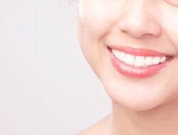 Transforming Smiles with Dental Veneers and Smile Makeovers: A Complete Guide