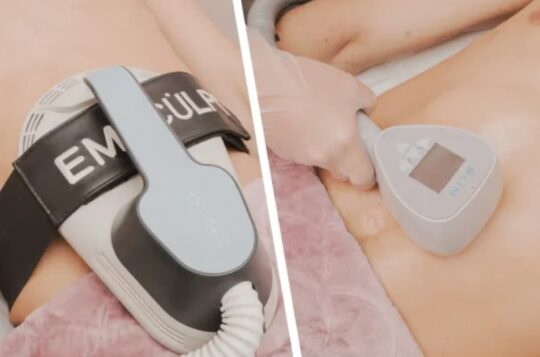 Emsculpt vs. Exilis: MOLD Manila Breaks Down the Best Body Contouring Treatment for Real Results