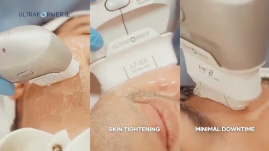 MOLD Manila Shares the Spotlight on Ultraformer Deep Dive: The Ultrasound Lift Redefining Non-Surgical Beauty in Quezon City